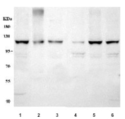 Western blot testing of human 1) HeLa, 2) PC-3, 3) K562, 4) A431, 5) A549 and 6) HepG2 cell lysate with FAK antibody. FAK has numerous isoforms and is routinely observed in western blot between 80~125 kDa.