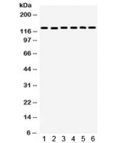 Western blot testing of 1) rat lung, 2) mouse lung, 3) rat brain, 4) human U20S, 5) human HeLa, 6) mouse NIH3T3 lysate with FAK antibody. FAK has numerous isoforms and is routinely observed in western blot between 80~125 kDa.