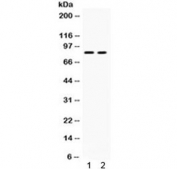 Western blot testing of human 1) HeLa and 2) HepG2 cell lysate with ZP2 antibody. Expected/observed molecular weight ~82 kDa.