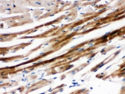IHC testing of FFPE mouse heart with SHP-2 antibody. HIER: Boil the paraffin sections in pH 6, 10mM citrate buffer for 20 minutes and allow to cool prior to staining.