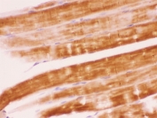 IHC testing of FFPE rat skeletal muscle with SHP-2 antibody. HIER: Boil the paraffin sections in pH 6, 10mM citrate buffer for 20 minutes and allow to cool prior to staining.