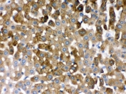 IHC testing of FFPE rat liver with SULT2A1 antibody. HIER: Boil the paraffin sections in pH8 EDTA buffer for 20 minutes and allow to cool prior to staining.