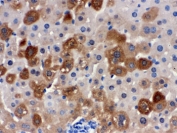 IHC testing of FFPE mouse liver with SULT2A1 antibody. HIER: Boil the paraffin sections in pH8 EDTA buffer for 20 minutes and allow to cool prior to staining.