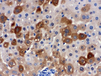 IHC testing of FFPE mouse liver with SULT2A1 antibody. HIER: Boil the paraffin sections in pH 6, 10mM citrate buffer for 20 minutes and allow to cool prior to staining.