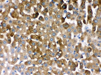IHC testing of FFPE rat liver with SULT2A1 antibody. HIER: Boil the paraffin sections in pH 6, 10mM citrate buffer for 20 minutes and allow to cool prior to staining.