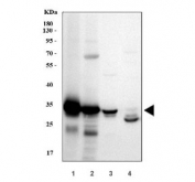 Western blot testing of 1) human HCCT (hepatocellular carcinoma tumor),  2) human HCCP (hepatocellular carcinoma paracancerous), 3) human HepG2 and 4) rat liver lysate with SULT2A1 antibody. Expected molecular weight ~34 kDa.
