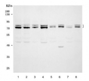 Western blot testing of 1) human HeLa, 2) human 293T, 3) human Jurkat, 4) human K562, 5) rat brain, 6) rat liver, 7) mouse brain and 8) mouse liver lysate with FMRP antibody. Predicted molecular weight ~71 kDa with multiple isoforms observed at 67-90 kDa.