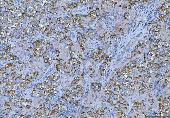 IHC staining of FFPE human testicular seminoma tissue with FRMP antibody. HIER: boil tissue sections in pH8 EDTA for 20 min and allow to cool before testing.