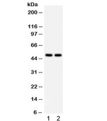 Western blot testing of human 1) MCF7 and 2) 293 cell lysate with SOX4 antibody. Expected/observed molecualr weight ~47 kDa.~