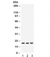 Western blot testing of human 1) placenta, 2) A431 and 3) HeLa lysate with MIG antibody. Expected/observed molecular weight ~19 kDa.