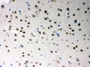 IHC testing of FFPE mouse brain with SF2 antibody. HIER: Boil the paraffin sections in pH 6, 10mM citrate buffer for 20 minutes and allow to cool prior to staining.