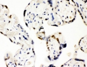 Western blot testing of 1) rat brain, 2) rat testis, 3) NEURO, 4) 293 and 5) SW620 lysate with SF2 antibody. Predicted/observed molecular weight ~28 kDa.