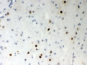 IHC testing of FFPE rat brain with SF2 antibody. HIER: Boil the paraffin sections in pH 6, 10mM citrate buffer for 20 minutes and allow to cool prior to staining.