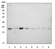 Western blot testing of 1) human HeLa, 2) human SW620, 3) human MCF7, 4) human 293T, 5) rat brain, 6) rat liver, 7) mouse brain and 8) mouse liver tissue lysate with SF2 antibody. Predicted molecular weight ~28 kDa.