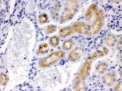 IHC testing of FFPE mouse kidney with CYP24A1 antibody. HIER: Boil the paraffin sections in pH 6, 10mM citrate buffer for 20 minutes and allow to cool prior to staining.