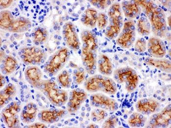IHC testing of FFPE rat kidney with CYP24A1 antibody. HIER: Boil the paraffin sections in pH 6, 10mM citrate buffer for 20 minutes and allow to cool prior to staining.