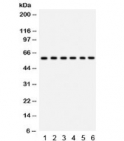 Western blot testing of 1) rat thymus, 2) rat lung, 3) HeLa, 4) 22RV1, 5) A431 and 6) mouse HEPA lysate with CYP24A1 antibody. Predicted/observed molecular weight ~59 kDa.