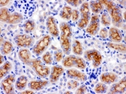 IHC testing of FFPE rat kidney with CYP24A1 antibody. HIER: Boil the paraffin sections in pH 6, 10mM citrate buffer for 20 minutes and allow to cool prior to staining.