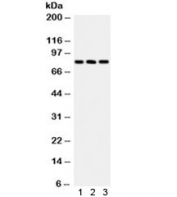 Western blot testing of human 1) HeLa, 2) A549 and 3) COLO320 lysate with Calcineurin A antibody. Predicted molecular weight ~61 kDa, observed here at ~84 kDa.