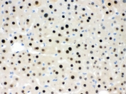 IHC testing of FFPE mouse liver with RBBP4 antibody. HIER: Boil the paraffin sections in pH 6, 10mM citrate buffer for 20 minutes and allow to cool prior to staining.