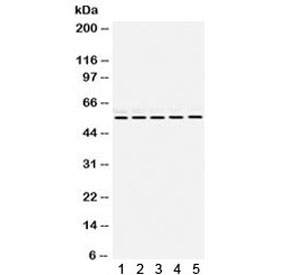 Western blot testing of 1) rat brain, 2) mouse liver, 3) mouse lung, 4) human HeLa, 5) human Jurkat with RBBP4 antibody. Expected molecular weight: 48~55 kDa.