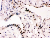IHC testing of frozen human placental tissue with RBBP4 antibody.