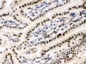 IHC testing of frozen mouse small intestine tissue with RBBP4 antibody.