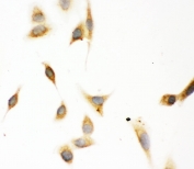 ICC staining of FFPE human A549 cells with ASPH antibody at 1ug/ml. HIER: Boil the paraffin sections in pH 6, 10mM citrate buffer for 20 minutes and allow to cool prior to staining.