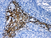 IHC testing of FFPE human tonsil with TRAF2 antibody. HIER: Boil the paraffin sections in pH 6, 10mM citrate buffer for 20 minutes and allow to cool prior to staining.