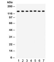 Western blot testing of 1) rat lung, 2) mouse lung, 3) HeLa, 4) MM231, 5) COLO320, 6) A549 and 7) mouse NIH3T3 lysate with SAP97 antibody. Predicted molecular weight: ~103 kDa, rountinely observed at ~140 kDa (Ref 1).~