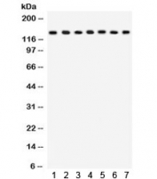 Western blot testing of 1) rat lung, 2) mouse lung, 3) HeLa, 4) MM231, 5) COLO320, 6) A549 and 7) mouse NIH3T3 lysate with SAP97 antibody. Predicted molecular weight: ~103 kDa, rountinely observed at ~140 kDa (Ref 1).