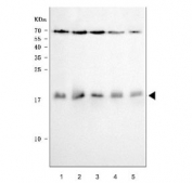 Western blot testing of 1) human MOLT-4, 2) human T-47D, 3) human Daudi, 4) human RT4 and 5) rat PC-12 cell lysate with PTP4A2 antibody. Expected molecular weight ~19 kDa.