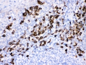 IHC testing of FFPE human tonsil with Peroxiredoxin 4 antibody. HIER: Boil the paraffin sections in pH 6, 10mM citrate buffer for 20 minutes and allow to cool prior to staining.