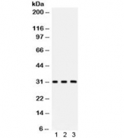 Western blot testing of 1) rat brain, 2) mouse brain and 3) human HeLa lysate with Peroxiredoxin 4 antibody. Expected/observed molecualr weight ~31 kDa.