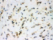 IHC testing of FFPE rat brain with Peroxiredoxin 4 antibody. HIER: Boil the paraffin sections in pH 6, 10mM citrate buffer for 20 minutes and allow to cool prior to staining.