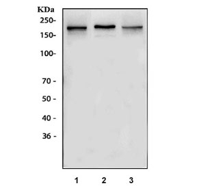 Western blot testing of 1) rat brain and 2) mouse brain lysate with NMDAR2B antibody. Expected molecular weight ~166 kDa, observed here at ~220 kDa.