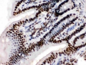IHC testing of FFPE mouse intestinal tissue with TRIM28 antibody. HIER: Boil the paraffin sections in pH8 EDTA buffer for 20 minutes and allow to cool prior to staining.