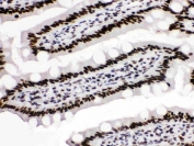 IHC testing of FFPE rat intestinal tissue with TRIM28 antibody. HIER: Boil the paraffin sections in pH8 EDTA buffer for 20 minutes and allow to cool prior to staining.