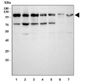 Western blot testing of 1) human HeLa, 2) human PC-3, 3) human 293T, 4) human A549, 5) rat PC-12, 6) mouse spleen and 7) mouse NIH 3T3 cell lysate with TRIM28 antibody. Observed molecular weight: 88~110 kDa depending on sumoylation.