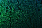 Immunofluorescent staining of FFPE human ovarian cancer tissue with TRIM28 antibody (green) and DAPI nuclear stain (blue). HIER: steam section in pH8 EDTA for 20 min.