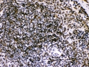 IHC testing of FFPE mouse spleen with BIK antibody. HIER: Boil the paraffin sections in pH 6, 10mM citrate buffer for 20 minutes and allow to cool prior to staining.
