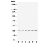 Western blot testing of 1) rat spleen, 2) rat stomach, 3) rat intestine, 4) human MCF7, 5) human A549 and 6) human SKOV lysate with BIK antibody. Expected molecular weight ~18 kDa but routinely observed at 18-22 kDa.