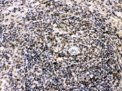 IHC testing of FFPE rat spleen with BIK antibody. HIER: Boil the paraffin sections in pH 6, 10mM citrate buffer for 20 minutes and allow to cool prior to staining.