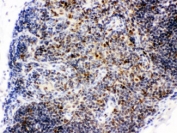 IHC testing of FFPE mouse thymus tissue with CTBP1 antibody. HIER: Boil the paraffin sections in pH 6, 10mM citrate buffer for 20 minutes and allow to cool prior to staining.