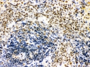 IHC testing of FFPE rat spleen tissue with CTBP1 antibody. HIER: Boil the paraffin sections in pH 6, 10mM citrate buffer for 20 minutes and allow to cool prior to staining.