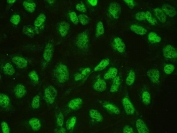 Immunofluorescent staining of FFPE human U-2 OS cells with CTBP1 antibody. HIER: steam section in pH6 citrate buffer for 20 min.