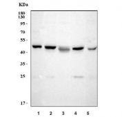 Western blot testing of 1) human SH-SY5Y, 2) human MOLT-4, 3) human MCF7, 4) rat PC-12 and 5) mouse SP2/0 cell lysate with CTBP1 antibody. Predicted molecular weight ~48 kDa.