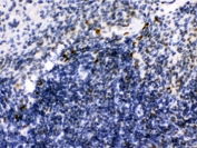 IHC testing of FFPE mouse spleen with IKAROS antibody. HIER: Boil the paraffin sections in pH 6, 10mM citrate buffer for 20 minutes and allow to cool prior to staining.