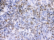 IHC testing of FFPE human human tonsil with IKAROS antibody. HIER: Boil the paraffin sections in pH 6, 10mM citrate buffer for 20 minutes and allow to cool prior to staining.