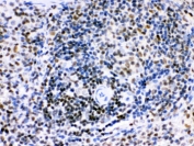 IHC testing of FFPE rat spleen with IKAROS antibody. HIER: Boil the paraffin sections in pH 6, 10mM citrate buffer for 20 minutes and allow to cool prior to staining.